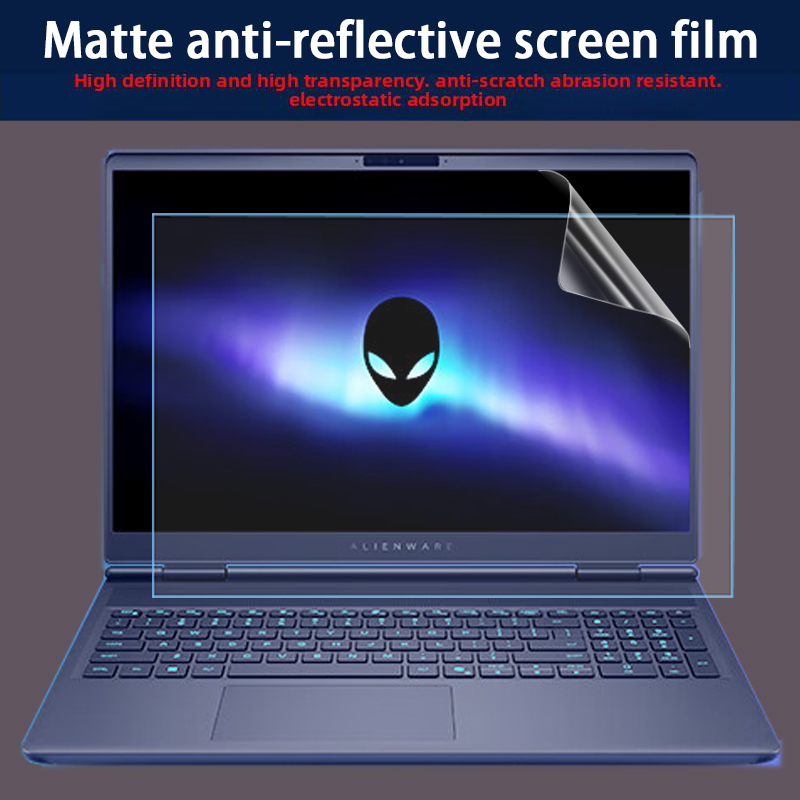 Für Dell Alienware 16X 16 Auro – Laptop Accessories Protector Bewertung und Preis